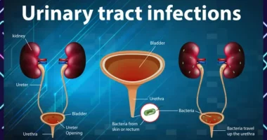 How harmful is Urinary Tract Infection?