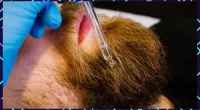 Possible Ways To Grow Beard Naturally - Faster And Effective Tips