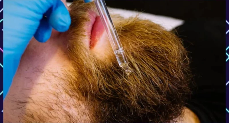 Possible Ways To Grow Beard Naturally - Faster And Effective Tips