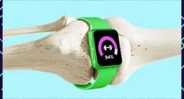 Bone Density Test Results: Implications and Foods to Eat for Improvement