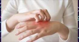 Psoriasis: Causes, Treatment And Complications