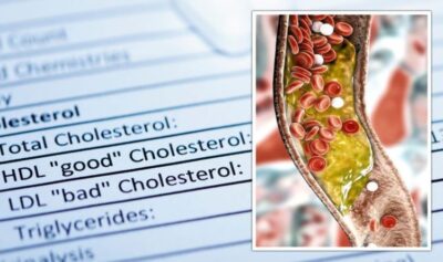 High Cholesterol: There is good and bad cholesterol but what’s the ...