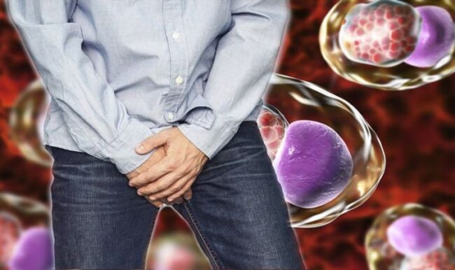 Chlamydia symptoms: The six sensations felt in a man’s testicles ...