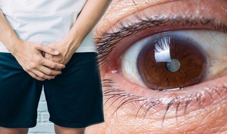 Gonorrhoea symptoms: The four signs to spot in your eyes warning of ...