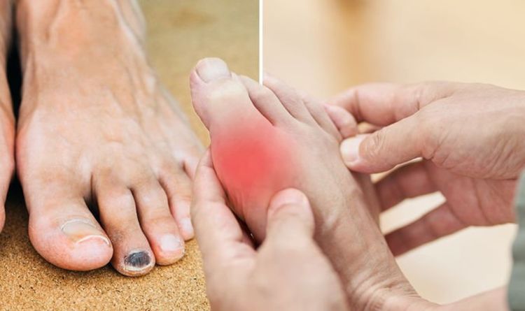 High Cholesterol Foot Pain