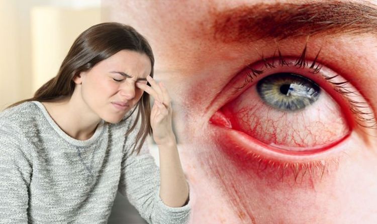 Pink eye: Three common sensations felt in the eyes warning of ...