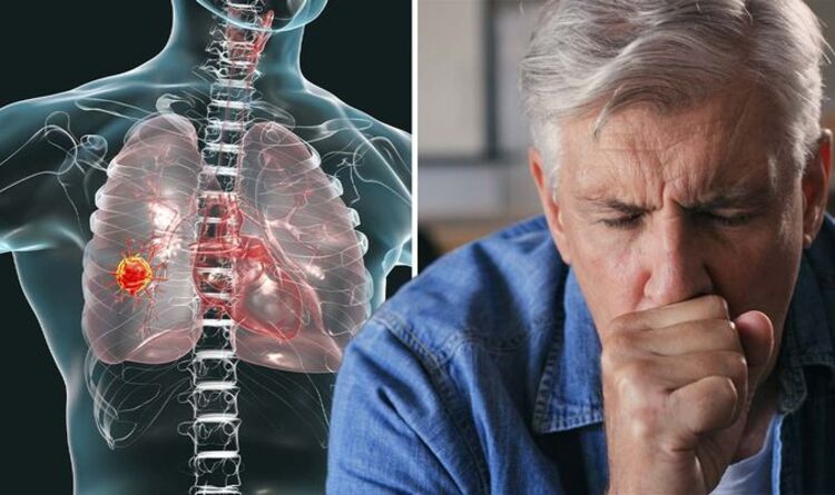 Lung cancer: Do you have hemoptysis? The ‘red flag’ sign that strikes ...