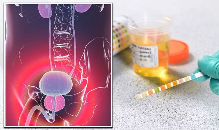 Prostate cancer symptoms: What colour is your urine? The key changes ...