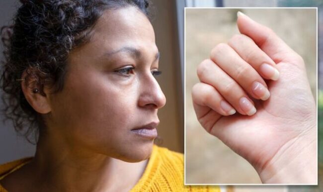 Vitamin B12 Deficiency Symptoms Are White Spots On Nails A Sign Dr