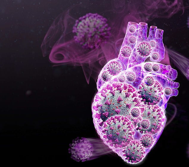 Are lingering Covid symptoms like shortness of breath and chest pain