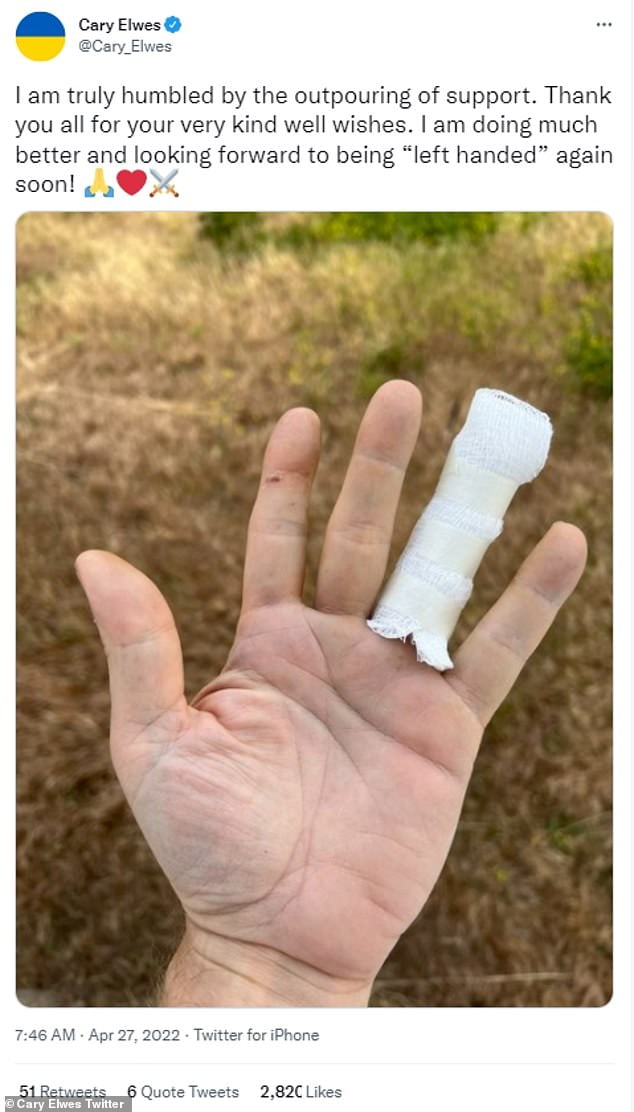 Cary Elwes, 59, shares image of bandaged finger after rattlesnake bite