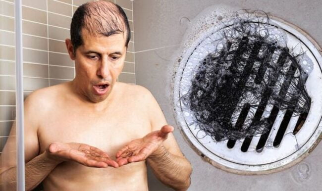 Hair Loss Can Washing Your Hair Too Much Cause Baldness Fact Checked 