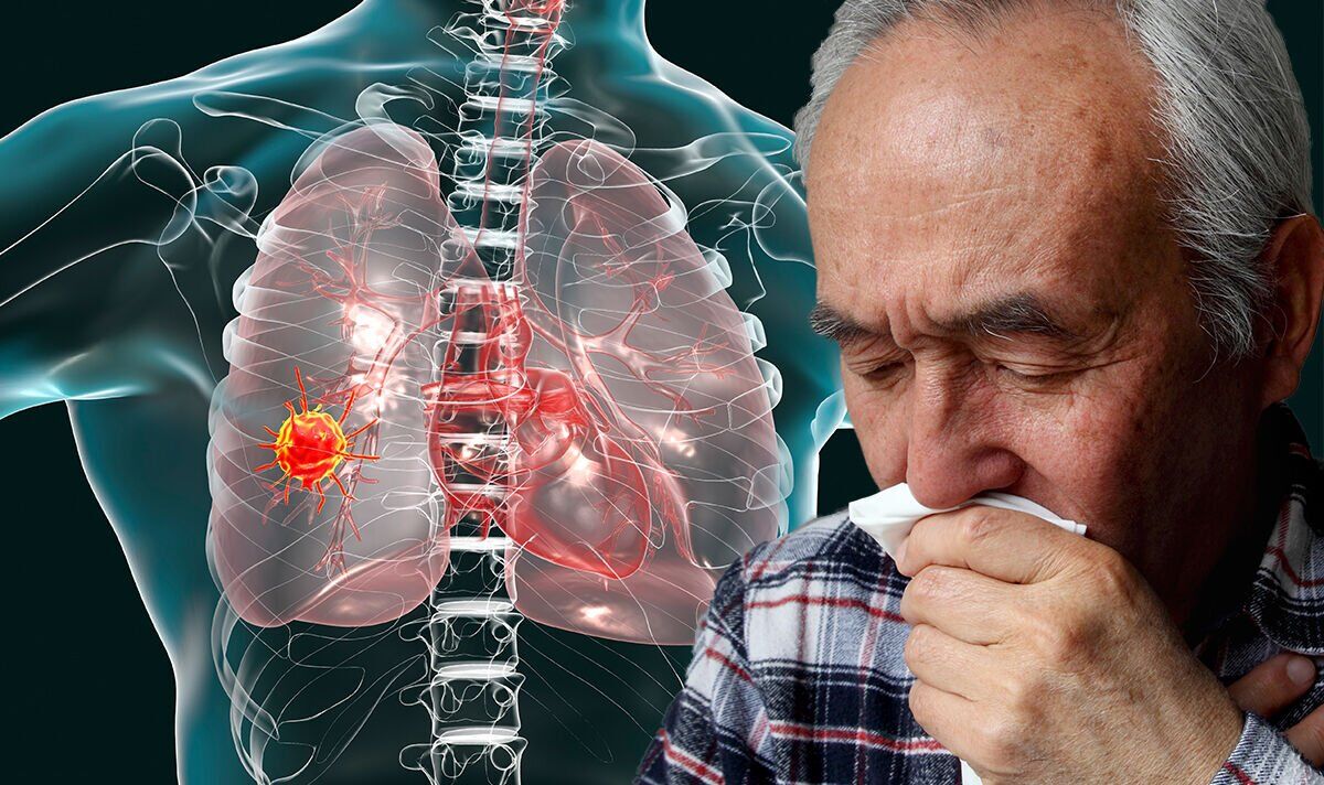lung-cancer-coughing-up-blood-and-other-signs-get-tested-at-your