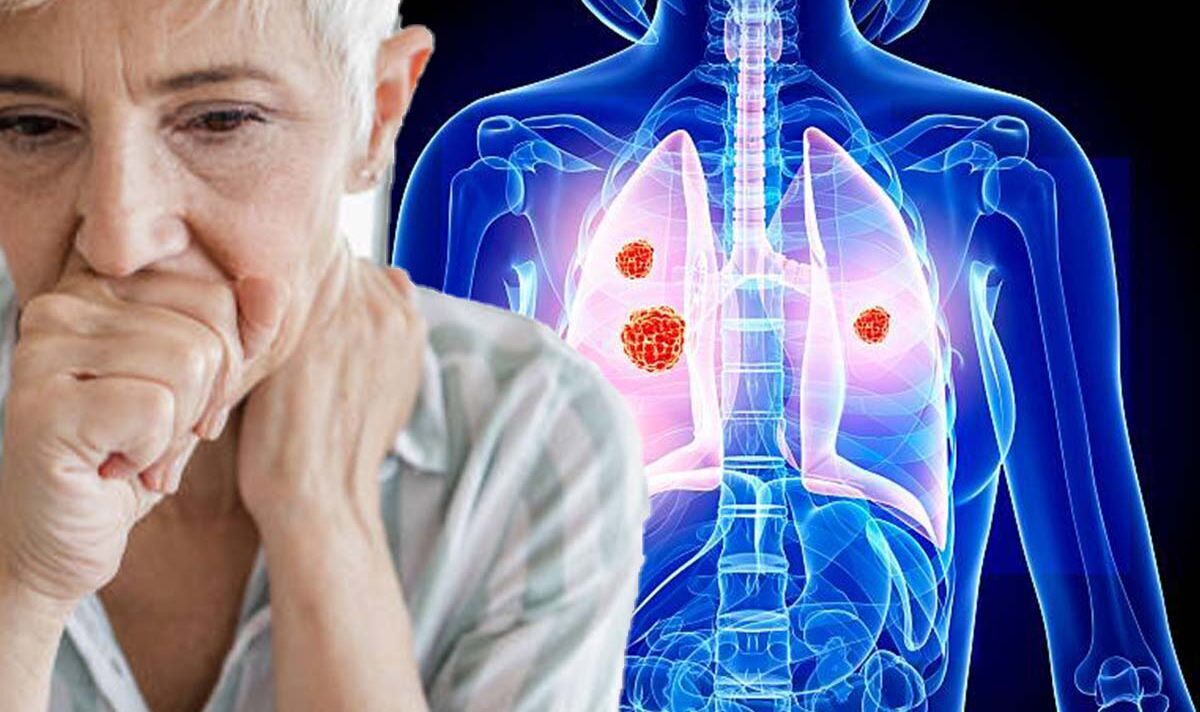 Lung cancer Have you had a new cough for longer than two weeks? That