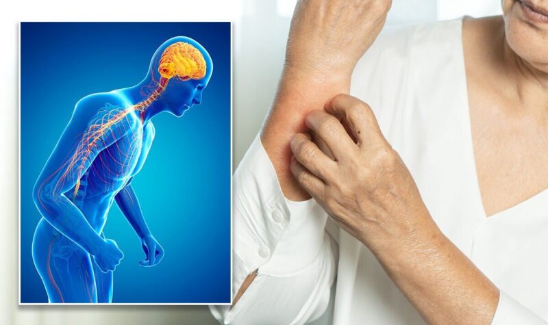 Parkinson’s disease symptoms: Skin condition ‘commonly found in people ...