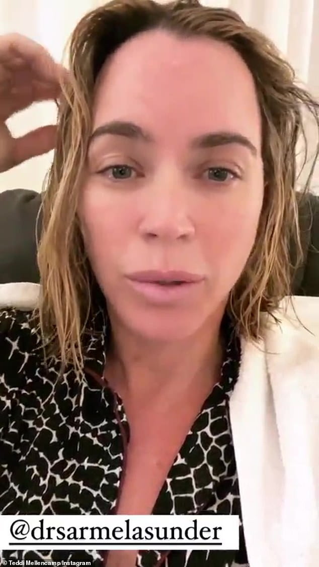 Teddi Mellencamp, 40, Reveals She Got A Neck Lift Because She Felt ...