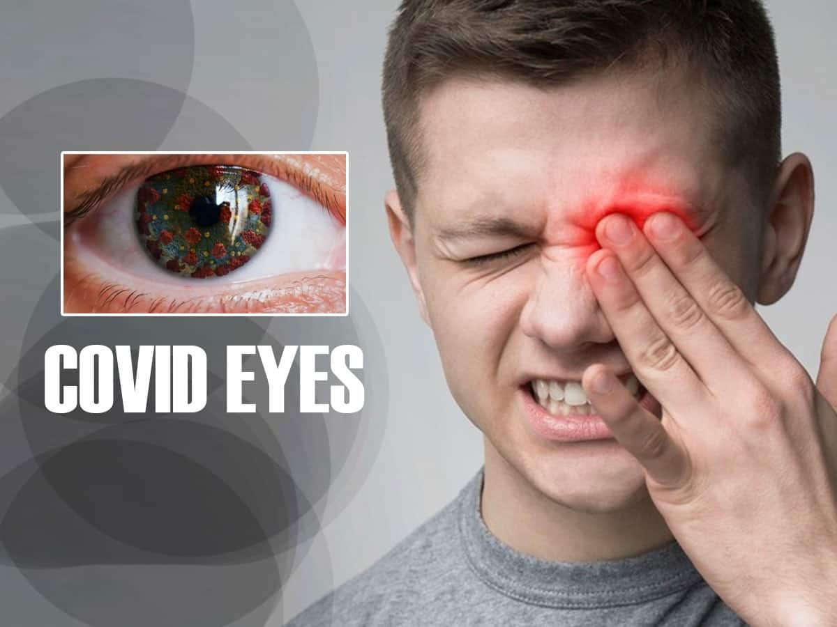 COVID Eyes: Sore Eyes And Other Symptoms Your Eyes May Show After Getting Infected