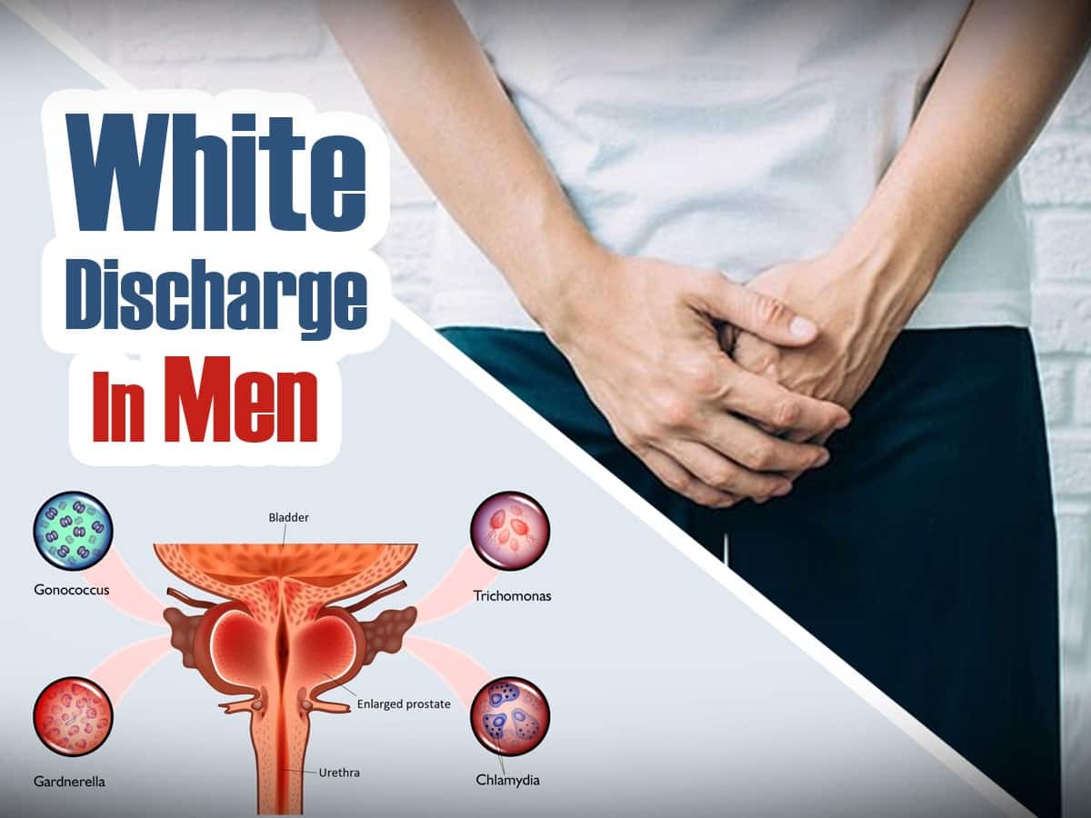 White Discharge In Men: What Causes Unusual Penis Discharge?