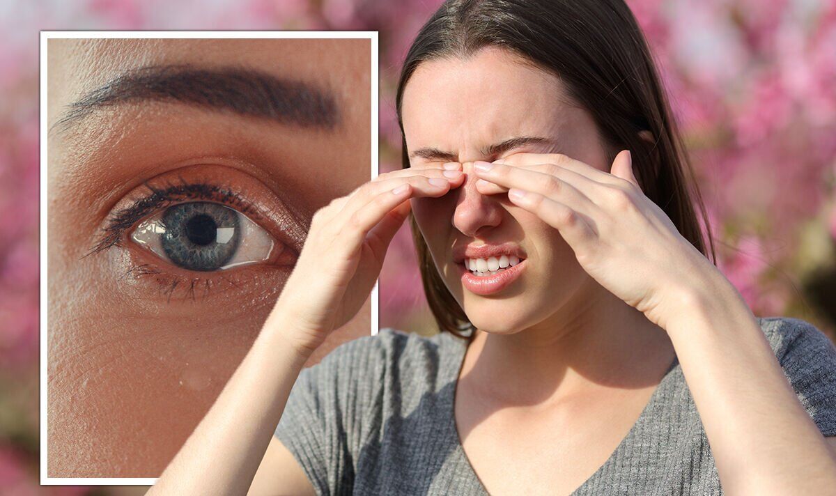 Hay fever The 'best' ways to prevent sore, swollen eyes, and sneezing fits this summer Sound