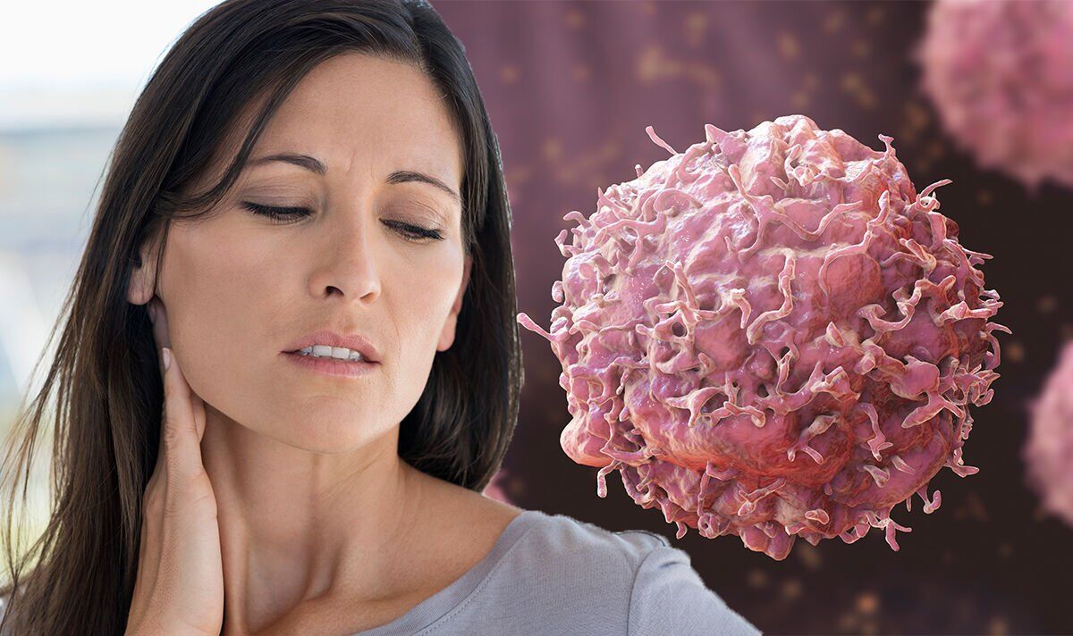 Tonsil cancer The 'painless' sign in your neck that could indicate the deadly disease Sound