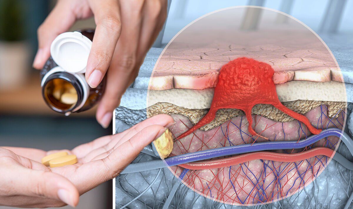 Skin cancer patients lacking a certain vitamin less likely to survive