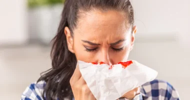 What to do if you can’t stop the nosebleed
