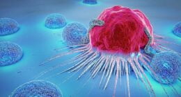 Did Alex Jackson Have Cancer? Cause Of Death Explained