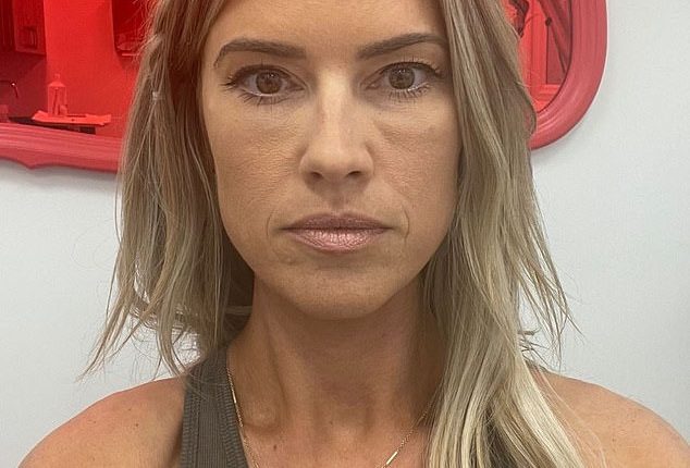 Christina Hall reveals she had such a bad reaction to fillers she had ...