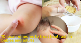 10 local remedies to treat heat rash in babies and adults