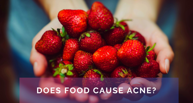 does-food-cause-acne-yes-but-not-alone-more-factors