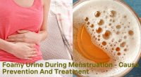 Foamy Urine During Menstruation - Cause, Prevention And Treatment