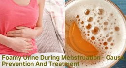 Foamy Urine During Menstruation - Cause, Prevention And Treatment