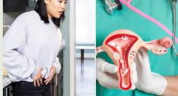 Dying symptoms of cervical cancer: the end-stage signs to watch out for