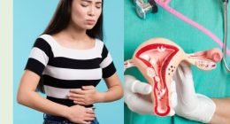 Is Cervical Cancer Deadly? Prevention Tips To Lower Your Risk