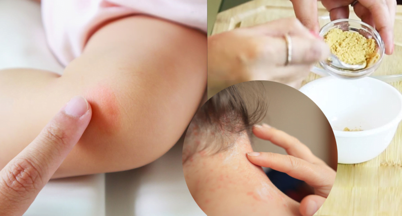 How long does heat rash last in babies and adults