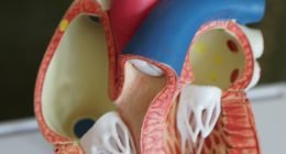 5 signs of clogged arteries