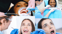 Disadvantages of deep cleaning teeth - facts to know