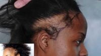 Hidden Causes of Hair Damage for African Women