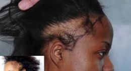 Hidden Causes of Hair Damage for African Women