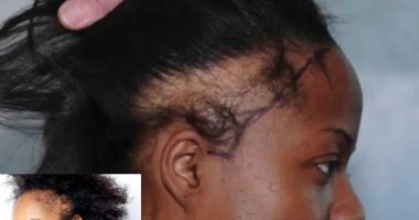 Hidden Causes of Hair Damage for African Women