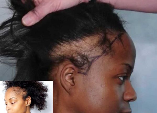 Hidden Causes of Hair Damage for African Women