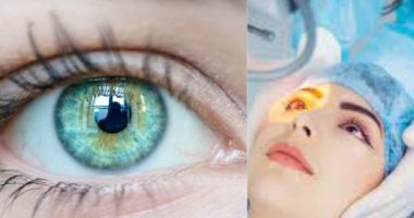 How Long After Cataract Surgery Can You Drive?
