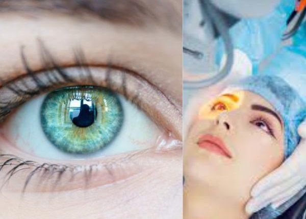 How Long After Cataract Surgery Can You Drive?