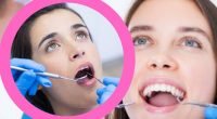 Teeth Cleaning Before and After: Benefits and Side Effects