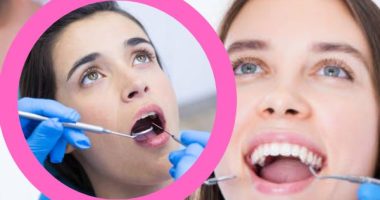 Teeth Cleaning Before and After: Benefits and Side Effects