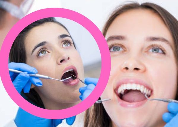 Teeth Cleaning Before and After: Benefits and Side Effects