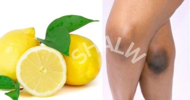 How to lighten dark armpits and knees fast at home