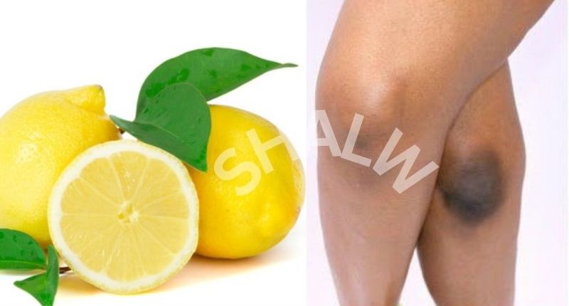 How to lighten dark armpits and knees fast at home