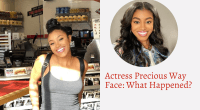Actress Precious Way Face: What Happened? Before And After