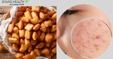 11 Incredible Side effects of Eating chin chin - Nigerian Snack